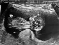 12weeks2days.jpg