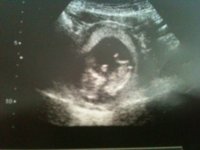 12wk scan.JPG