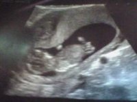 12 week scan.jpg