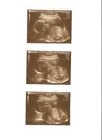 20 week scan 001.jpg