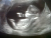 baby the one.jpg