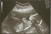 Baby Dalgarno 20 weeks.jpg