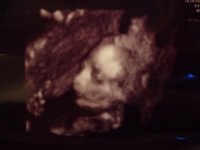 baby3.jpg