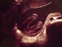 baby legs.jpg