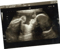 28 week.JPG