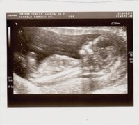 scan baby D 2 13 wks 3 days.jpg