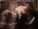 baby 23 w 3.jpg