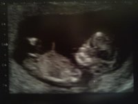 our baby xxx.jpg