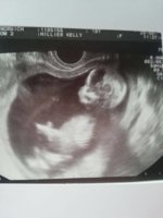 Baby scan!.jpg