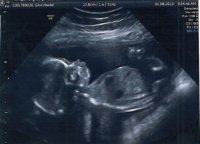 Baby 20 weeks - Copy.jpg