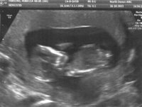 12 Week Scan 1.jpg