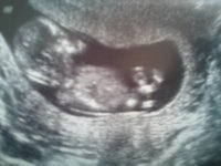 babypic2.jpg