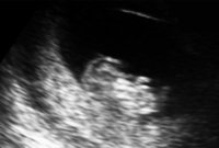 scan pic.jpg