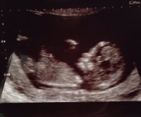 12+3 scan.jpg
