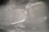 20131121_115424-1.jpg