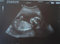 bub 20 weeksss.jpg