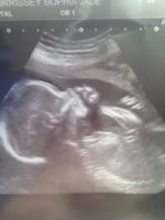 baby.jpg