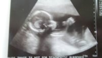 20weeks.jpg