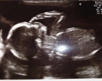 20 Weeks.JPG