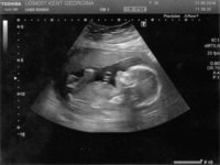 squidge_20weeks3.jpg