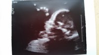 22 weeks high five.jpg