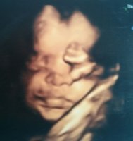 4D Scan.jpg