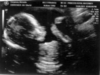 Shelly's baby(1).jpg