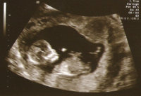 12 scan pic.jpg