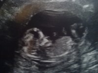 Baby.jpg