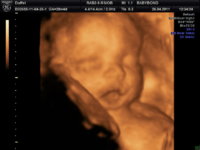 BABYBOND_19.JPG