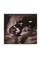 scan 12 weeks.jpg