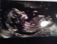 12 week scan - 02-01-2015.jpg