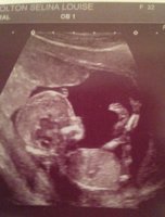 Our Baby 13+2 weeks.jpg