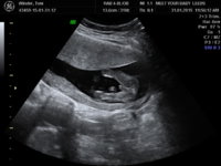 BABY TONI_5.JPG
