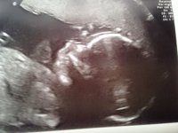 scan.jpg