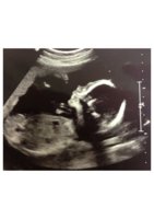 20 weeks.jpg