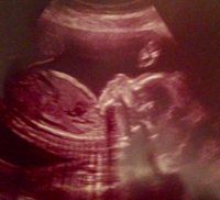 Our Baby 20+2 weeks.jpg
