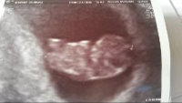 9 weeks scan.jpg